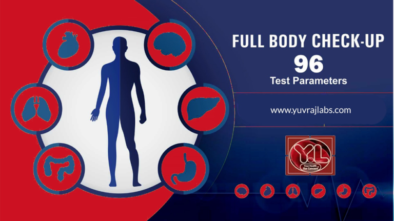 Full Body Checkup in Amritsar