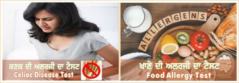 Food Allergy Test in Amritsar