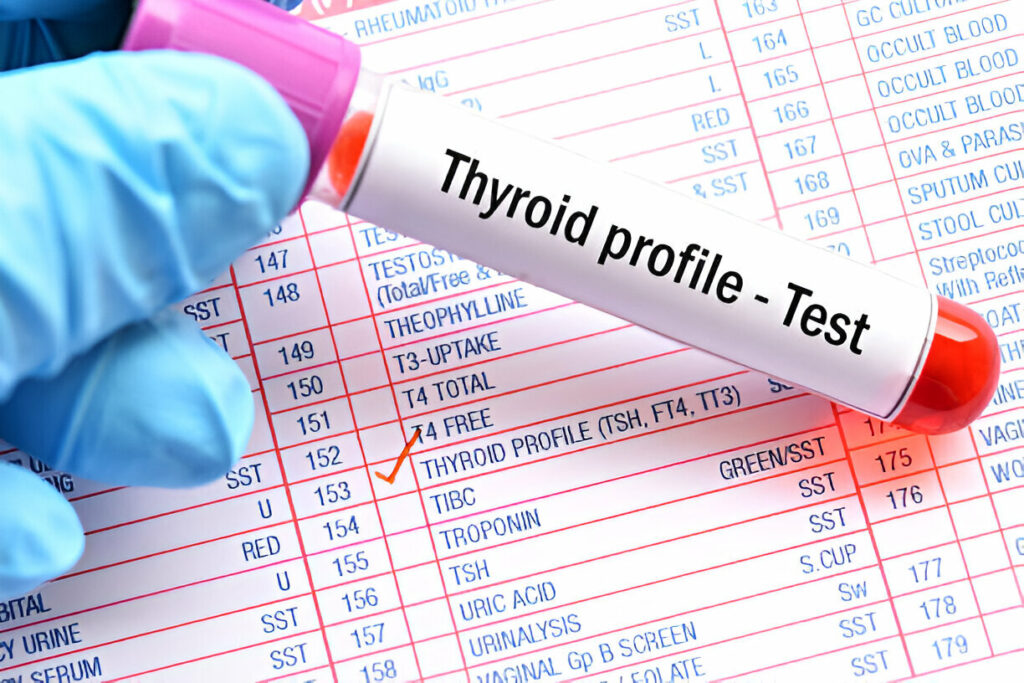 Thyroid Test in Amritsar