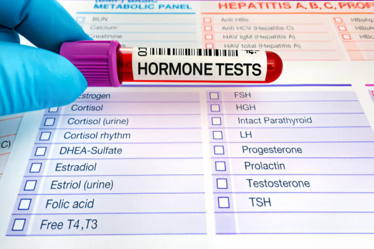 Hormones Test in Amritsar