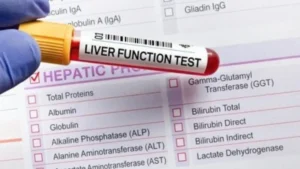 Liver Function Test in Amritsar