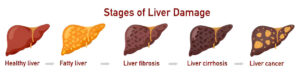 Liver Profile Test in Amritsar