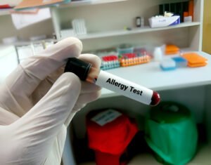 Allergy Test in Amritsar